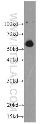 C9orf72 Antibody in Western Blot (WB)