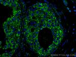 IL-4 Antibody in Immunohistochemistry (PFA fixed) (IHC (PFA))