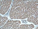 IL-6 Antibody in Immunohistochemistry (Paraffin) (IHC (P))