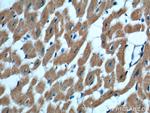 IL-6 Antibody in Immunohistochemistry (Paraffin) (IHC (P))