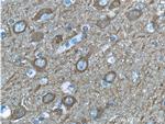 NSE Antibody in Immunohistochemistry (Paraffin) (IHC (P))