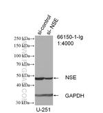 NSE Antibody in Western Blot (WB)