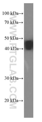 NSE Antibody in Western Blot (WB)