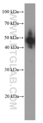 NSE Antibody in Western Blot (WB)