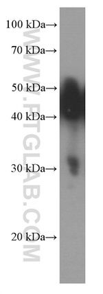 NSE Antibody in Western Blot (WB)