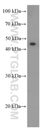 NSE Antibody in Western Blot (WB)