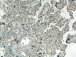 HBE1 Antibody in Immunohistochemistry (Paraffin) (IHC (P))