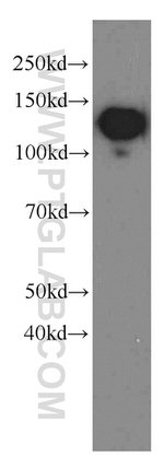 CD146/MCAM Antibody in Western Blot (WB)