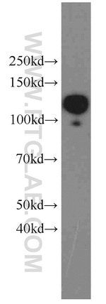 CD146/MCAM Antibody in Western Blot (WB)