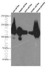 CD146/MCAM Antibody in Western Blot (WB)