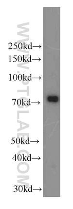 NUMBL Antibody in Western Blot (WB)