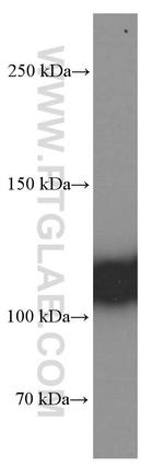 C3/C3b/C3c Antibody in Western Blot (WB)