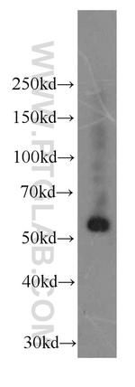 Fibrinogen gamma chain Antibody in Western Blot (WB)