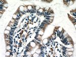 NAPRT1 Antibody in Immunohistochemistry (Paraffin) (IHC (P))