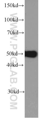 NAPRT1 Antibody in Western Blot (WB)