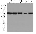 NAPRT1 Antibody in Western Blot (WB)