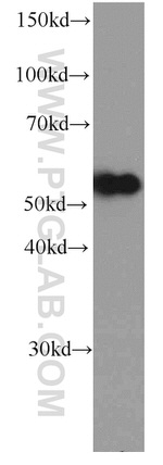 NAPRT1 Antibody in Western Blot (WB)