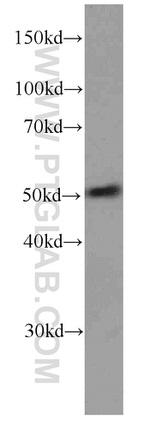 NAPRT1 Antibody in Western Blot (WB)