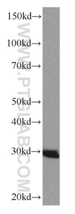 ANP32B Antibody in Western Blot (WB)