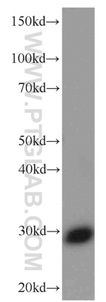 ANP32B Antibody in Western Blot (WB)