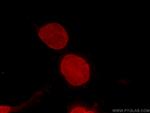 BMI1 Antibody in Immunocytochemistry (ICC/IF)