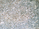 BMI1 Antibody in Immunohistochemistry (Paraffin) (IHC (P))