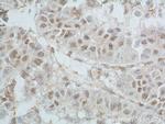 TBP Antibody in Immunohistochemistry (Paraffin) (IHC (P))