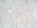 TBP Antibody in Immunohistochemistry (Paraffin) (IHC (P))