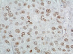 TBP Antibody in Immunohistochemistry (Paraffin) (IHC (P))