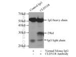 Claudin 18 Antibody in Immunoprecipitation (IP)
