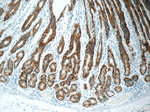 Claudin 18 Antibody in Immunohistochemistry (Paraffin) (IHC (P))