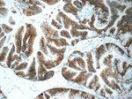 Claudin 18 Antibody in Immunohistochemistry (Paraffin) (IHC (P))