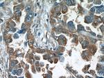 RCAS1 Antibody in Immunohistochemistry (Paraffin) (IHC (P))