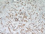 RCAS1 Antibody in Immunohistochemistry (Paraffin) (IHC (P))