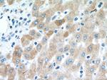 Transferrin Antibody in Immunohistochemistry (Paraffin) (IHC (P))