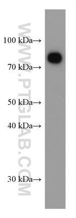 Transferrin Antibody in Western Blot (WB)