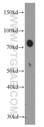 Transferrin Antibody in Western Blot (WB)