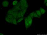 MSH6 Antibody in Immunocytochemistry (ICC/IF)