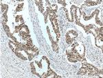 MSH6 Antibody in Immunohistochemistry (Paraffin) (IHC (P))