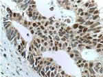 MSH6 Antibody in Immunohistochemistry (Paraffin) (IHC (P))