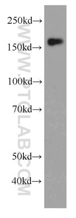 MSH6 Antibody in Western Blot (WB)