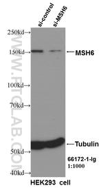 MSH6 Antibody in Western Blot (WB)