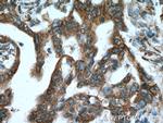 CNPY2/MSAP Antibody in Immunohistochemistry (Paraffin) (IHC (P))