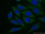 USP13 Antibody in Immunocytochemistry (ICC/IF)