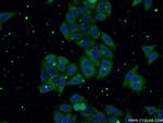 USP13 Antibody in Immunocytochemistry (ICC/IF)