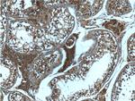 USP13 Antibody in Immunohistochemistry (Paraffin) (IHC (P))