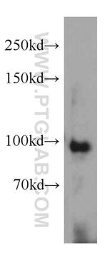 USP13 Antibody in Western Blot (WB)