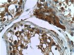 PSMD4 Antibody in Immunohistochemistry (Paraffin) (IHC (P))