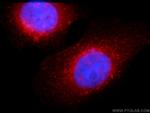 CD71 Antibody in Immunocytochemistry (ICC/IF)