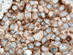 CD71 Antibody in Immunohistochemistry (Paraffin) (IHC (P))